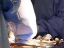 Bimba piuma operata al cuore a Milano, salvata da San Raffaele-San Donato Bimba piuma operata al cuore a Milano, salvata da San Raffaele-San Donato