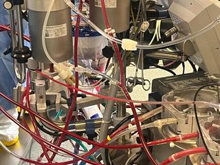 Il team della Cardiochirurgia durante un intervento e una immagine di circolazione extracorporea Il team della Cardiochirurgia durante un intervento e una immagine di circolazione extracorporea