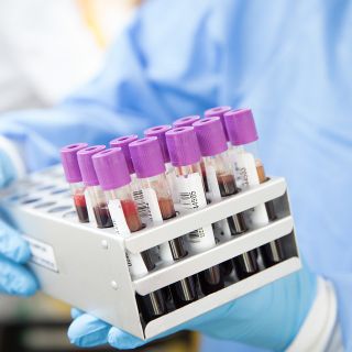 Coronavirus, i dati di lunedì 22 febbraio: nel Varesotto 34 contagi. Varese +1, Busto +4, Gallarate +2, Saronno +1