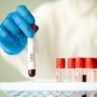 Coronavirus, il punto in provincia: Varese +37, Busto +27, Gallarate +29, Saronno +15