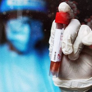 Coronavirus, i dati di domenica 7 febbraio: nel Varesotto 73 contagi. Varese +7, Busto +6, Gallarate +6, Saronno +5