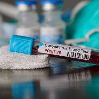 Coronavirus, il punto in provincia: Varese +3, Busto +7, Gallarate +5, Saronno 0