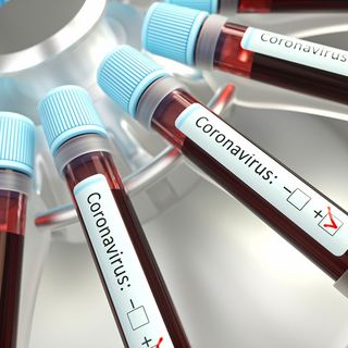 Covid-19, in Italia oggi 10.630 contagi e 422 vittime. In Lombardia 1.625 nuovi positivi