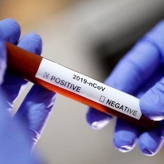 Coronavirus, il punto in provincia: Varese +14, Busto +8, Gallarate +31, Saronno +3