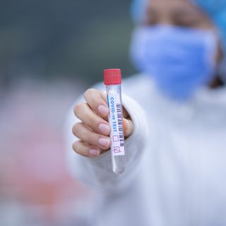 Coronavirus, in provincia di Varese 148 nuovi contagi. In Lombardia 1.431 casi e 2 vittime