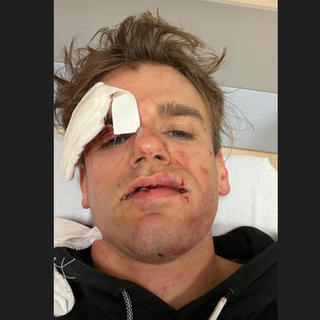 Aggredito e rapinato a Varese Jacopo Malnati de iPantellas