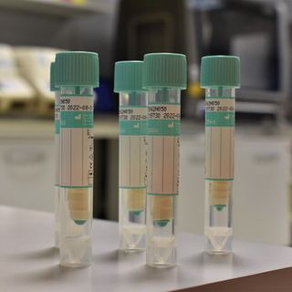 Covid, nuovi contagi: davanti c'è sempre Varese (+15), poi Busto (+9) e Saronno (+5)