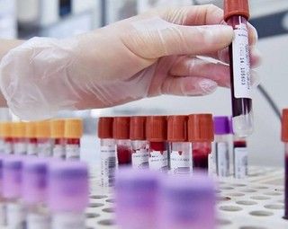 Covid, nell'ultima settimana in provincia di Varese 3.539 nuovi positivi