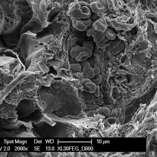 Nuove prospettive per il trattamento delle lesioni nei tessuti grazie a una ricerca Insubria