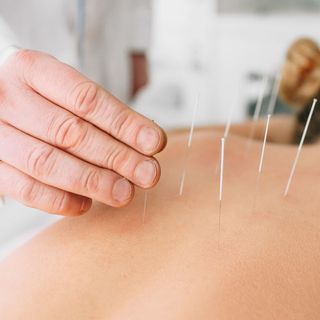 L'agopuntura approda all’ospedale di Tradate: tra tradizione orientale e innovazione clinica 