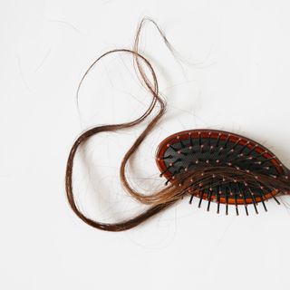 Alopecia: i rimedi per affrontarla