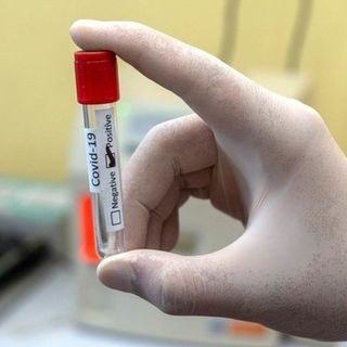 Covid, in provincia di Varese 9 contagi. In Lombardia sono 119 con 2 vittime