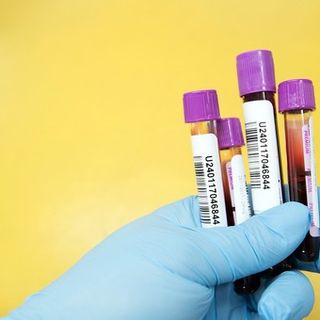 Direzione Welfare Lombardia: «Tutte le varianti del Covid sono efficacemente coperte a ciclo vaccinale completato»