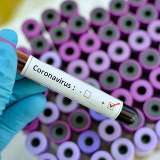 Coronavirus, oggi 89 contagi in provincia di Varese. In Lombardia 574 casi e nessuna vittima
