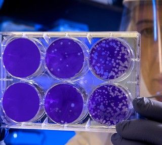 Coronavirus, in provincia di Varese oggi si scende (238 casi) così come in Lombardia (3.019) ma con meno tamponi