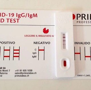 Coronavirus, in provincia di Varese 1.917 nuovi contagi. In Lombardia 27.808 casi