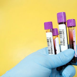 Covid-19, in Italia oggi 10.800 casi e 348 vittime. Veneto la regione più colpita con 1.682 positivi, in Lombardia sono 863