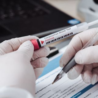Coronavirus, i dati di domenica 24 gennaio: nel Varesotto 64 contagi. Varese +3, Busto +7, Gallarate +6, Saronno +3