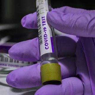 Covid-19, in Italia oggi 18.627 e 361 vittime. La Lombardia torna la regione più colpita