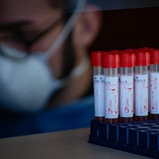 Coronavirus, i dati di giovedì 7 gennaio: nel Varesotto 566 contagi. Varese +50, Busto+52, Gallarate +30, Saronno +7