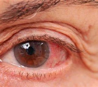 L'Oculistica dell'Asst Sette Laghi continua a crescere. Obiettivo Verbano