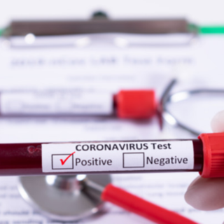 Coronavirus, in provincia di Varese 1.489 contagi. In Lombardia sono 18.180