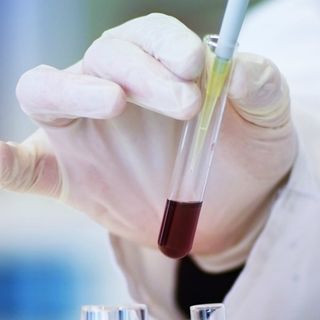 Punti prelievi, dopo Viggiù a pieno regime anche Malnate