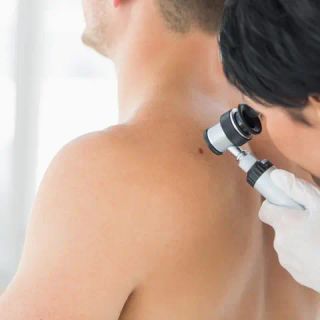 Effetti negativi del sole: invecchiamento precoce e tumori cutanei