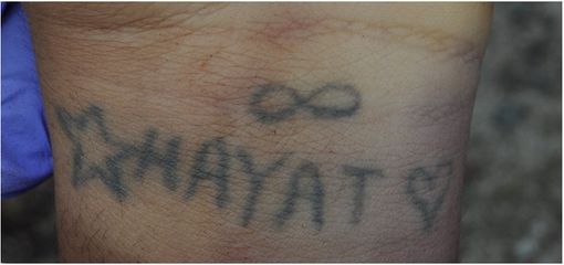 E' di un ragazzo di 22 anni il corpo senza vita trovato sulla piazzola della 336 di Malpensa