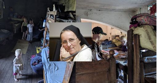 I bimbi albini in Madagascar rischiano la vita: l'appello di suor Marcella I bimbi albini in Madagascar rischiano la vita: l'appello di suor Marcella