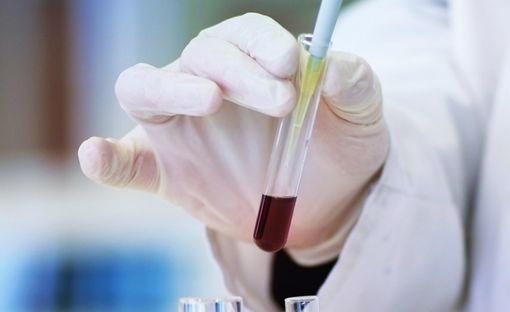 Punti prelievi, dopo Viggiù a pieno regime anche Malnate