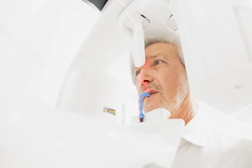 Impianti dentali: tecnologie avanzate, comfort e fiducia per tornare a sorridere