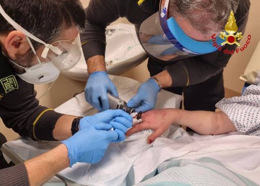 Anello incastrato al dito. Al Circolo per rimuoverlo arrivano i vigili del fuoco Anello incastrato al dito. Al Circolo per rimuoverlo arrivano i vigili del fuoco