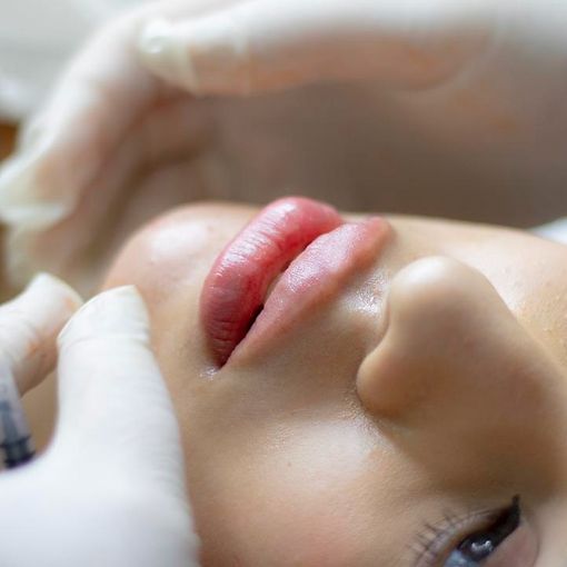 Bellezza: +20% botulino in Italia, ritocchi senza bisturi 2 volte più graditi