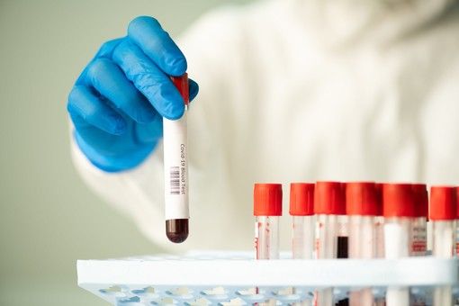 Coronavirus, il punto in provincia: Varese +37, Busto +27, Gallarate +29, Saronno +15