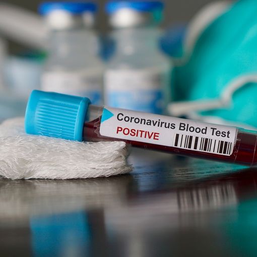 Coronavirus, il punto in provincia: Varese +3, Busto +7, Gallarate +5, Saronno 0