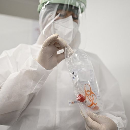 Coronavirus, il punto in provincia: Varese +67, Busto +63, Gallarate +35, Saronno +24