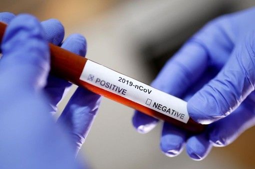 Coronavirus, il punto in provincia: Varese +14, Busto +8, Gallarate +31, Saronno +3