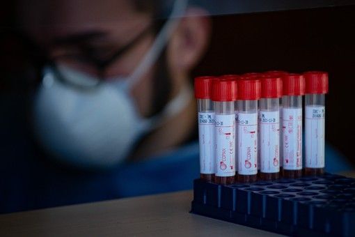 Coronavirus, il punto dei contagi in provincia: Varese +3, Busto +3, Gallarate 0, Saronno +1