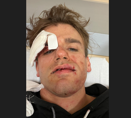 Aggredito e rapinato a Varese Jacopo Malnati de iPantellas