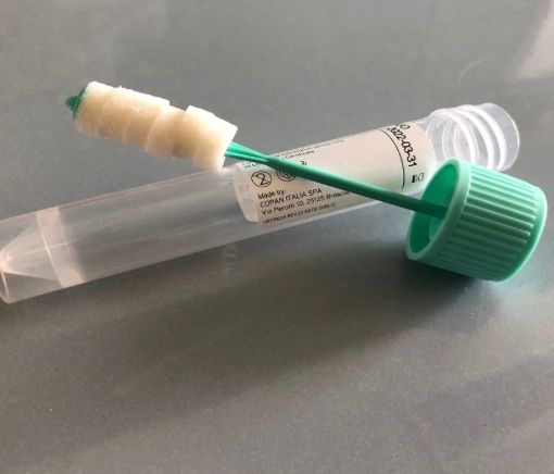 Ats Insubria: al via test salivari in soggetti fragili