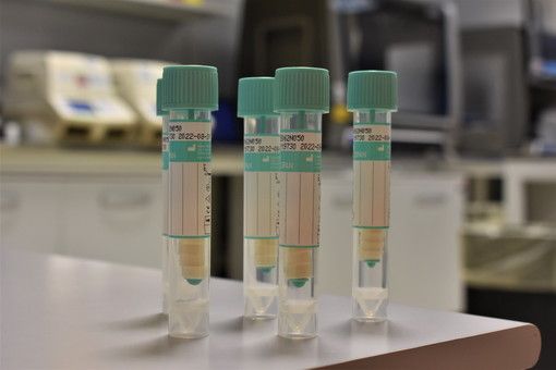 Covid-19, in Italia oggi 15.370 nuovi contagi e 310 vittime. Cresce il Varesotto, stabile la Lombardia