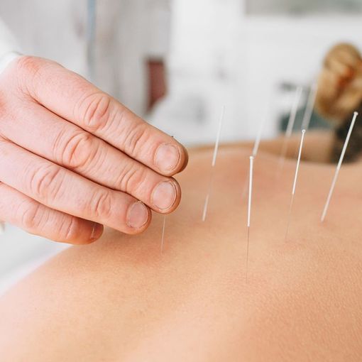 L'agopuntura approda all’ospedale di Tradate: tra tradizione orientale e innovazione clinica 
