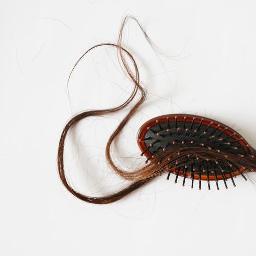 Alopecia: i rimedi per affrontarla