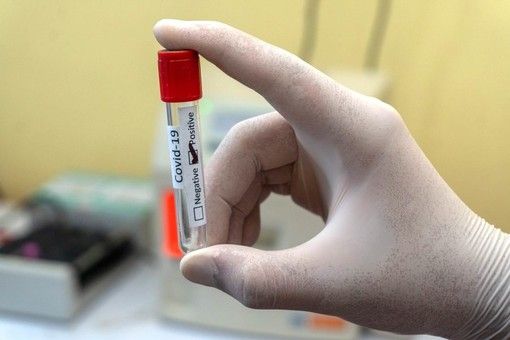 Covid, in provincia di Varese 9 contagi. In Lombardia sono 119 con 2 vittime