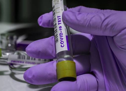 Coronavirus, i dati di domenica 3 gennaio: nel Varesotto 408 casi. Varese +25, Busto +43, Gallarate +6, Saronno +7