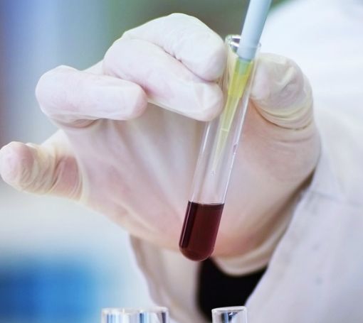 Punti prelievi, dopo Viggiù a pieno regime anche Malnate
