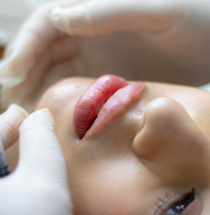Bellezza: +20% botulino in Italia, ritocchi senza bisturi 2 volte più graditi