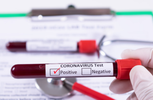 Coronavirus, il punto in provincia: Varese +44, Busto +37, Gallarate +18, Saronno +16