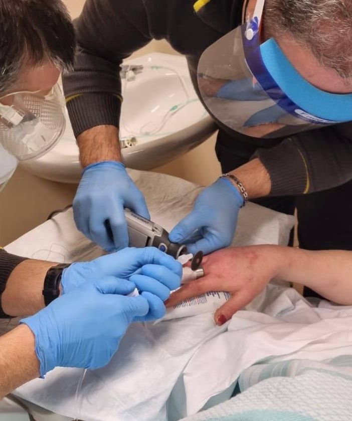 Anello incastrato al dito. Al Circolo per rimuoverlo arrivano i vigili del fuoco